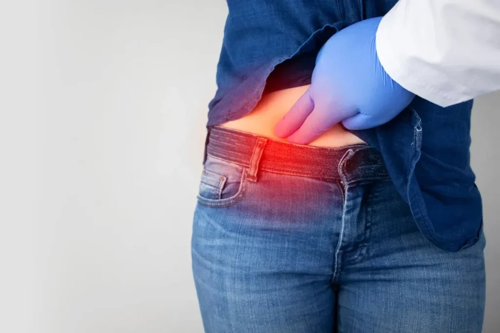 Appendicitis Symptoms: Pain Shifting to the Lower-Right Abdomen