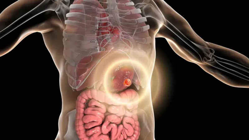Stomach Cancer Symptoms – Digestive Signs Mistaken For Gastritis