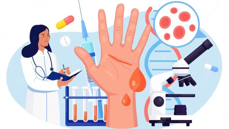 Hemophilia Symptoms – Excessive Bleeding And Bruising Signs