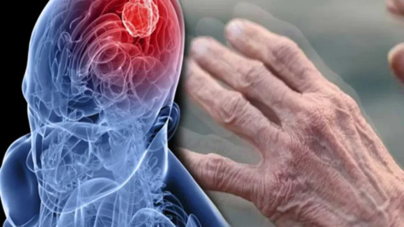 Parkinson’s Disease Symptoms – Tremors And Movement Changes Explained