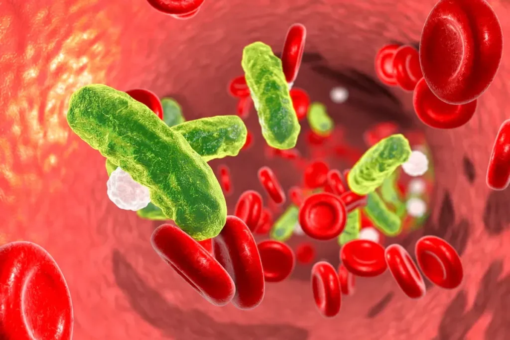 Sepsis Symptoms: Deadly Infection Warning Signs That Can Spread Fast