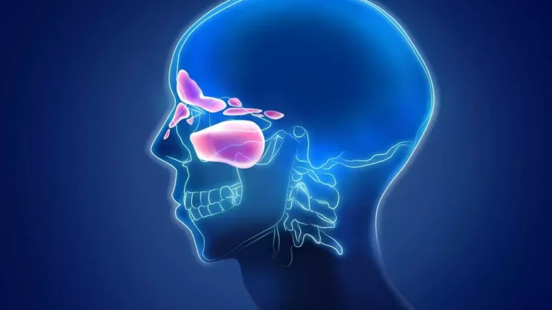 Sinusitis Symptoms – Facial Pain And Pressure Signs
